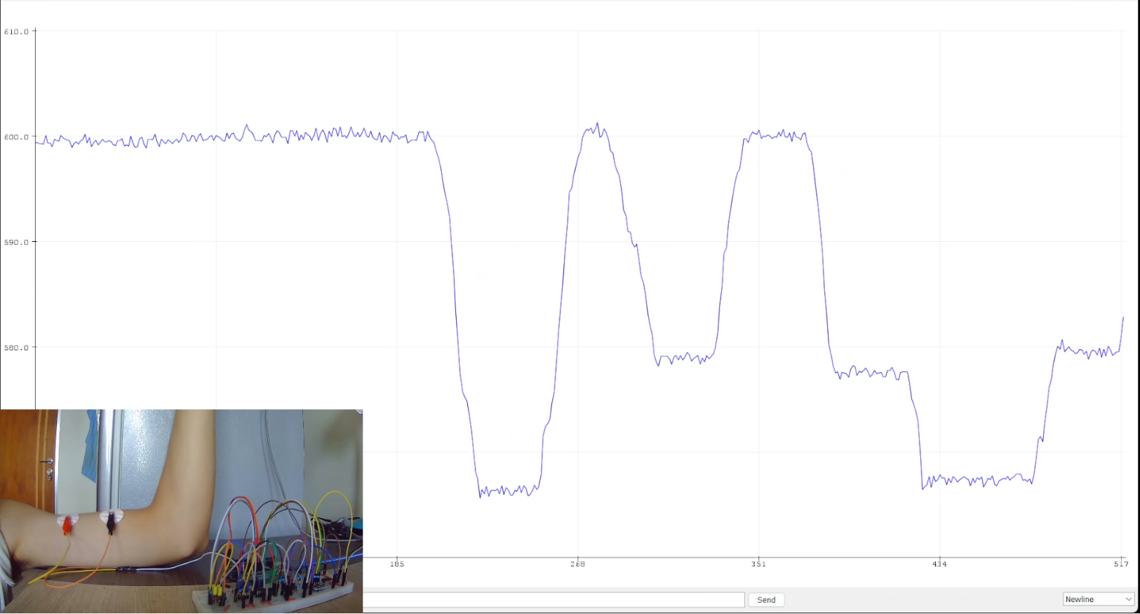 Hand angle estimation using bioimpedance